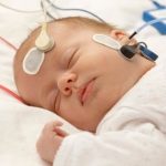 Klinik ABR (BERA) Testi