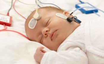 Klinik ABR (BERA) Testi